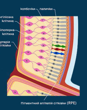 Утончение сетчатки